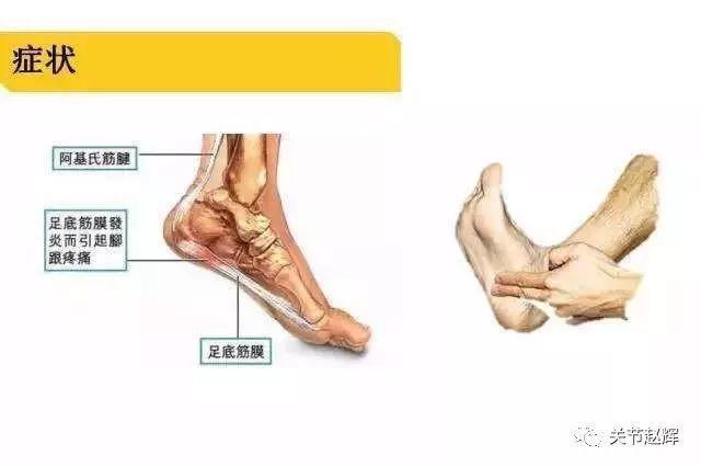 最新跑姿，科学、效率与健康的完美结合