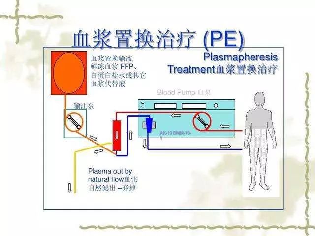 血浆治疗最新进展，探索血液疗法的无限可能